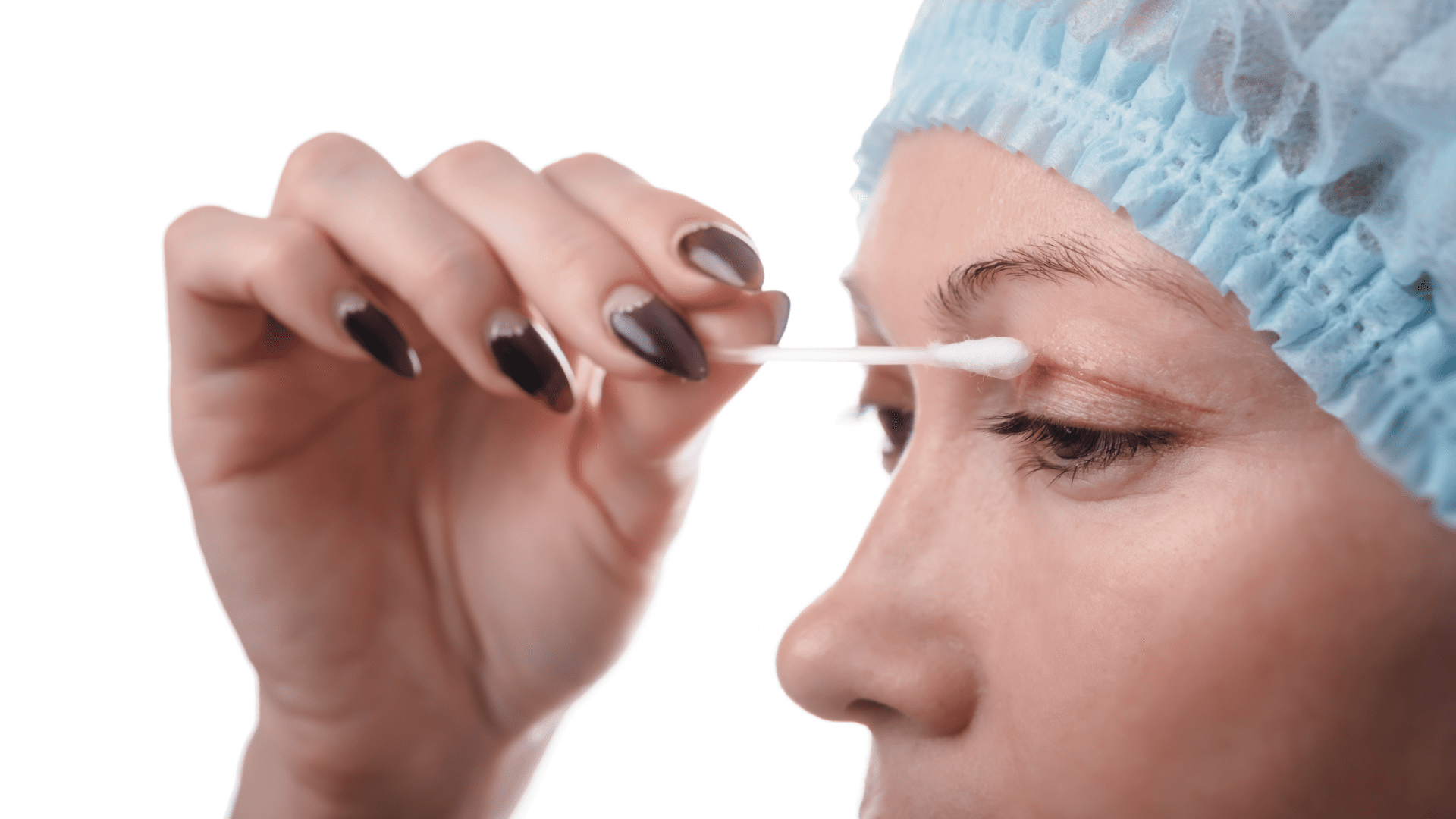 The Eyelid Lift Journey A Step-by-Step Guide to What to Expect Before, During, and After Your Procedure
